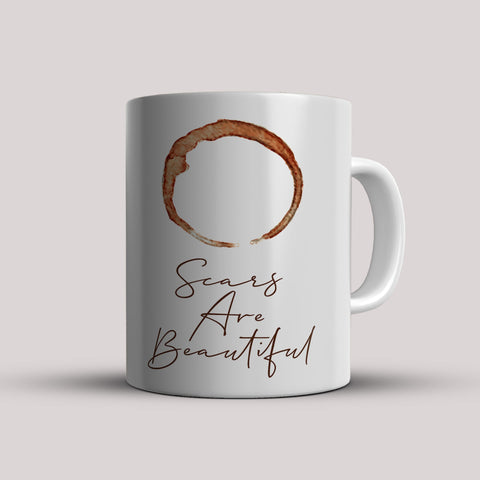 Chai: Scars Are Beautiful White Ceramic Mug